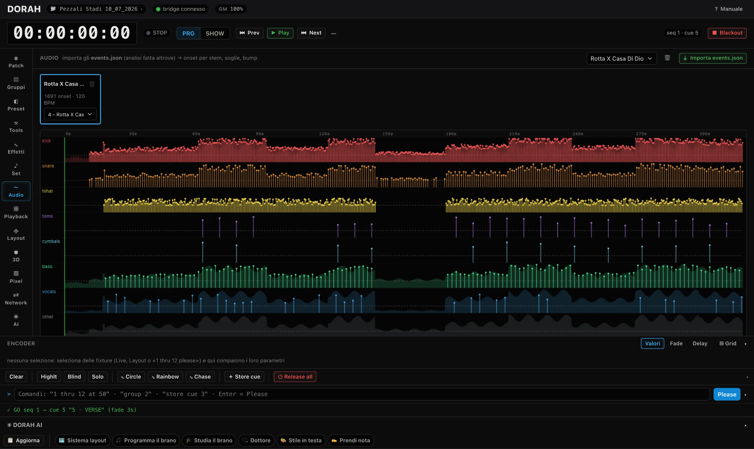 DORAH Audio view: colour-coded onset lanes for kick, snare, hi-hat, toms, cymbals, bass and vocals across the whole song